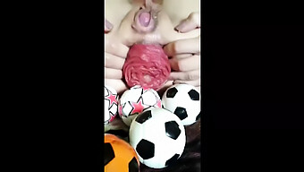 Extreme Anal Stretching And Prolapse